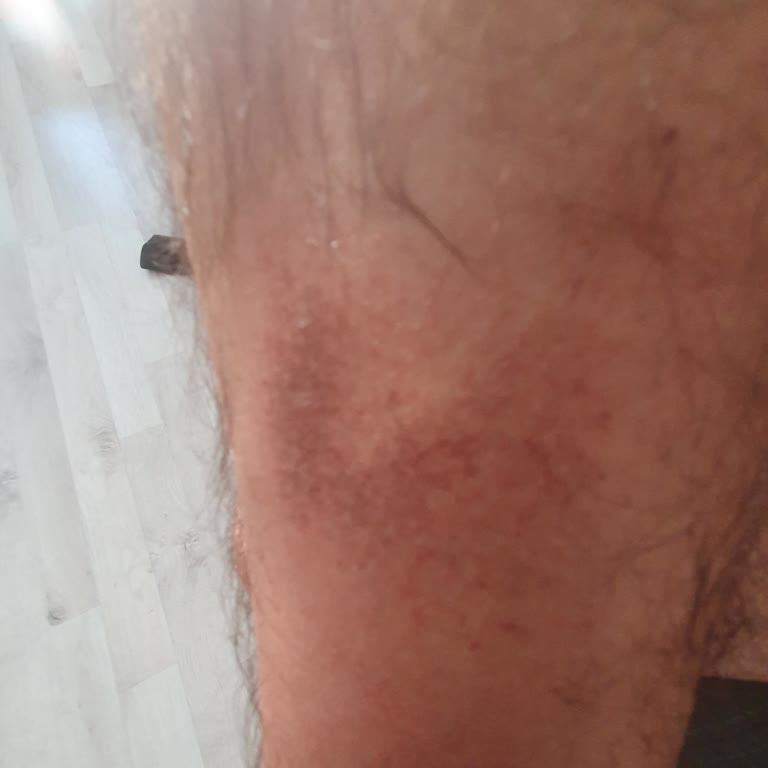 Eryaman Şubesi'nde Deneme Atışı Kabusu