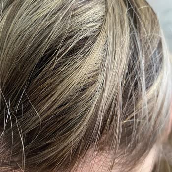 Vega Hair Design Bodrum Saçımı Yıkadığımda Yeşillenmeler Oldu