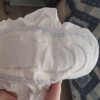 Molped Süper Night 16'da Üretim Hatası Şüphesi