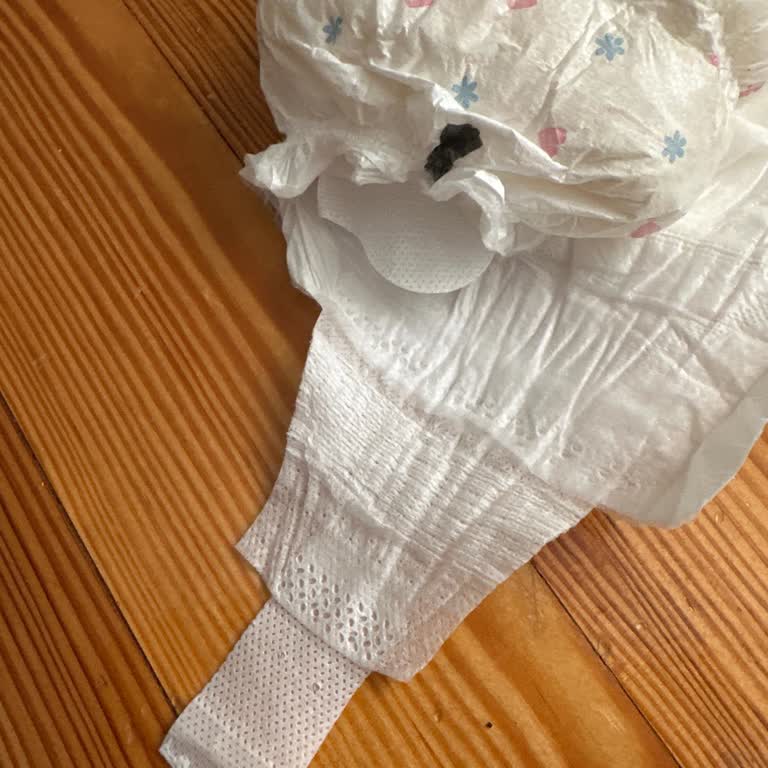 Migros Minies Bebek Bezi Kalite Sorunları