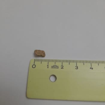 Migros Ürünlerinde Taş Parçası Tehlikesi