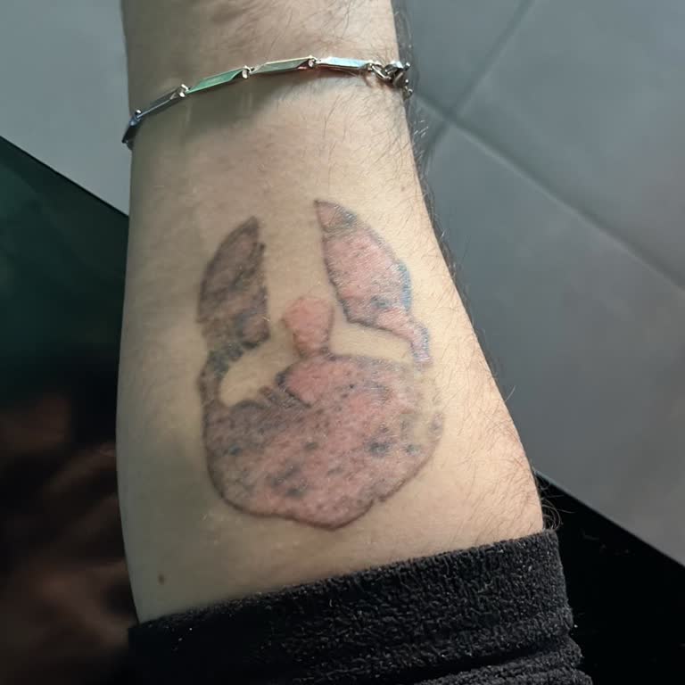 Başarısız Dövme Sildirme İşlemi Ve Yetki Sorunu