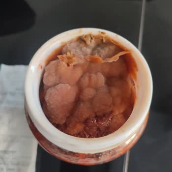 Küflü Ürün Şoku: A101 Mağazasındaki Sorun