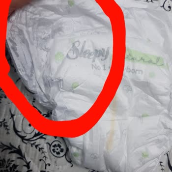 Sleepy Naturel Bebek Bezinde Cırt Cırt Sorunu