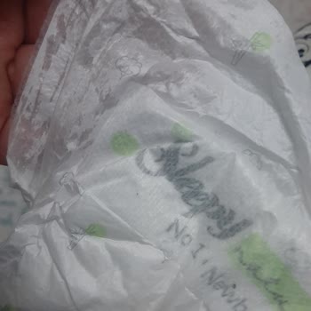 Sleepy Naturel Bebek Bezinde Cırt Cırt Sorunu