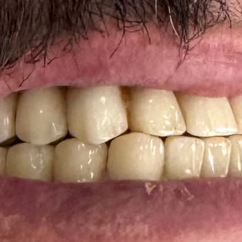 Alanya Dental Place Hayal Kırıklığı