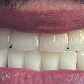 Alanya Dental Place Hayal Kırıklığı