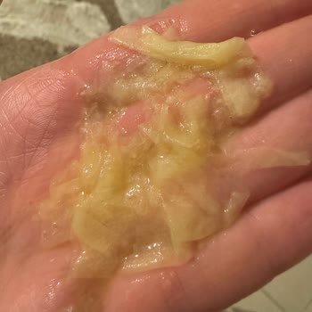 Yanlış Ve Bozuk Ürün Mağduriyeti