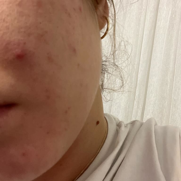 Tto Marka Yıkama Seti Cildimde Sorun Yarattı