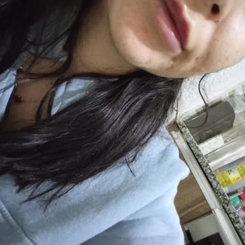 Larissa Beylikdüzü'nde Acılı Dolgu Deneyimi Ve İlgisizlik