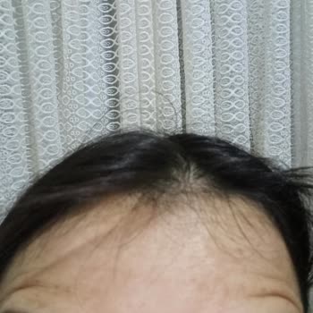 Larissa Beylikdüzü'nde Acılı Dolgu Deneyimi Ve İlgisizlik