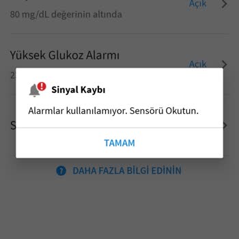 Ölçüm Yapmayan Ürün Ve Ulaşılmaz Müşteri Hizmetleri