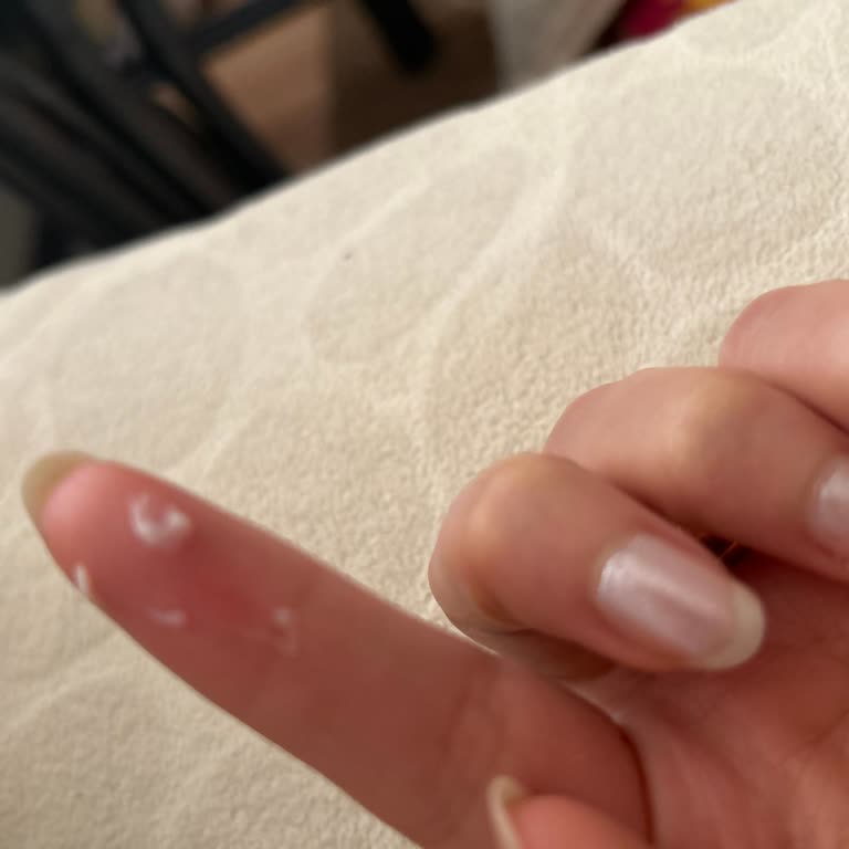 Sensodyne Kullanımı Sonrası Ağız İçi Sorunu