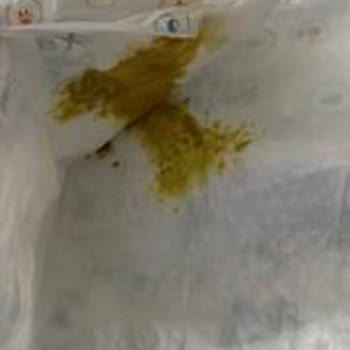 Teleskop Akvaryum Aldığımız Köpekler Hasta Çıktı Ve Kötü Muamele Gördük