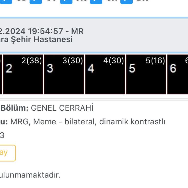 Geciken Raporlar Ve Uzayan Bekleyiş: Sağlık Hizmetlerinde Hayal Kırıklığı