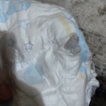 Molfix Bez Paketinden Çıkan Garip Şey