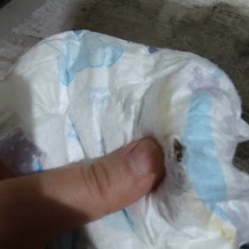 Molfix Bez Paketinden Çıkan Garip Şey