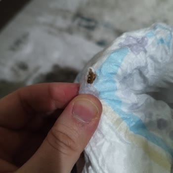 Molfix Bez Paketinden Çıkan Garip Şey