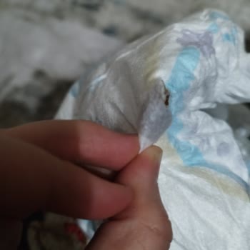 Molfix Bez Paketinden Çıkan Garip Şey