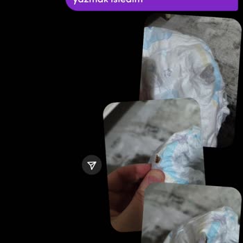 Molfix Bez Paketinden Çıkan Garip Şey