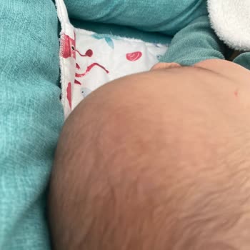 Bebek Şampuanı Kullanımı Sonrası Şok Edici Alerjik Reaksiyon