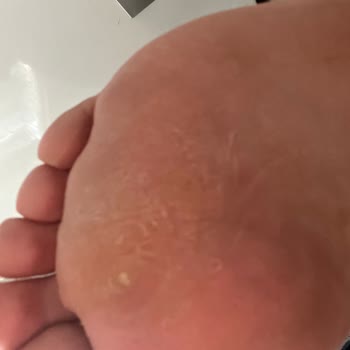 Memory Foam Ayakkabıların Neden Olduğu Sağlık Sorunları