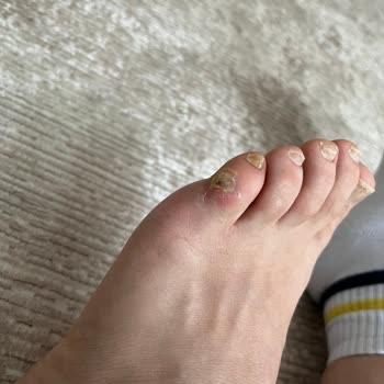 Memory Foam Ayakkabıların Neden Olduğu Sağlık Sorunları