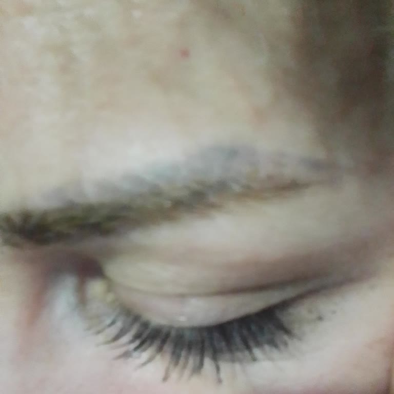 Kalıcı Kaş Uygulamasında Mağduriyet