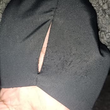 Garanti Sözü Verilen Üründe Tüylenme Sorunu