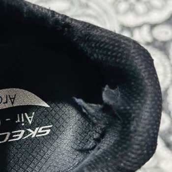 Skechers Ürününde Beklenmedik Yıpranma