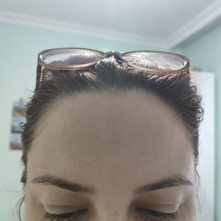Bioderma Atoderm Cream Caused Swelling and Irritation