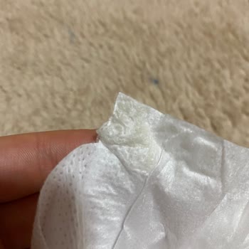 Molfix Bebek Bezinde Yabancı Cisim Sorunu
