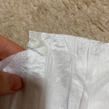 Molfix Bebek Bezinde Yabancı Cisim Sorunu