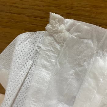 Molfix Bebek Bezinde Yabancı Cisim Sorunu