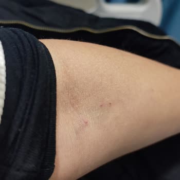 Hastanede Rapor Alamama Ve Özel Hastaneye Mecbur Kalma