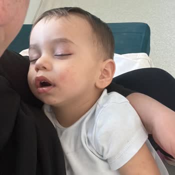 Sleepy Bebek Bezinden Kaynaklanan Alerji Kabusu!