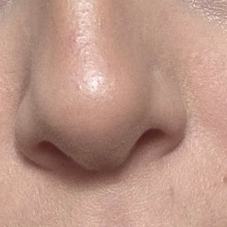 Producto Kiko Milano causa irritación en la piel