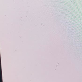 Pahalı Ekran Koruyucu Mağduriyeti: Blueo Markasına Güvenebilir Miyiz