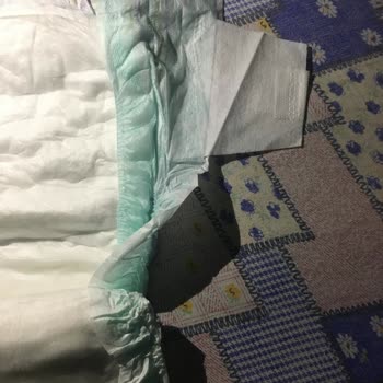 Hatalı Bebek Bezi Bantları Ve Sızıntı Sorunu