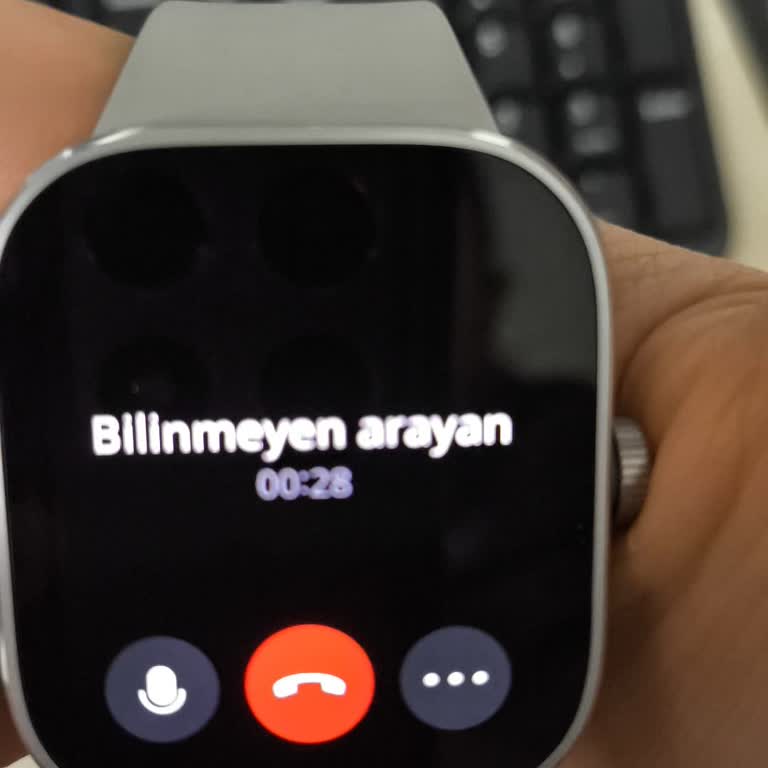 Xiaomi Redmi Watch 4'te Gizemli Çağrılar Ve Erişim Sorunları