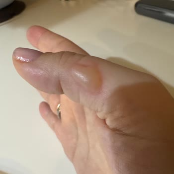 Schafer Tava Kullanımında Yağ Sıçraması Sorunu