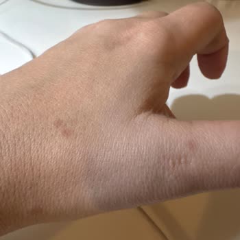 Schafer Tava Kullanımında Yağ Sıçraması Sorunu