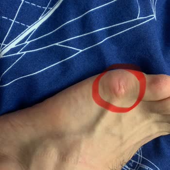 Dikiş Problemi Ve Hatalı Ürün Değişim Deneyimi