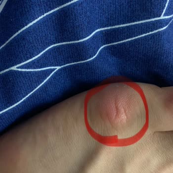 Dikiş Problemi Ve Hatalı Ürün Değişim Deneyimi
