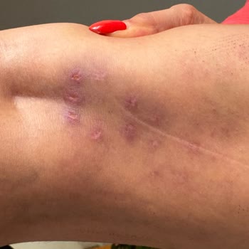 Nodda Beauty Center Şikayetçiyim