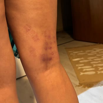 Nodda Beauty Center Şikayetçiyim