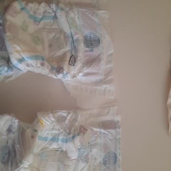 Molfix Bebek Bezlerinde Kesik Gibi Sorun Ve Kayma Problemi