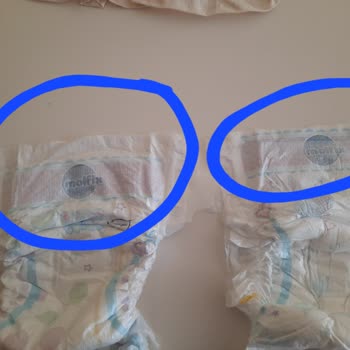 Molfix Bebek Bezlerinde Kesik Gibi Sorun Ve Kayma Problemi