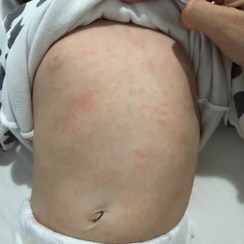 Bebek Cildine Uygun Olmayan Krem Sorunu