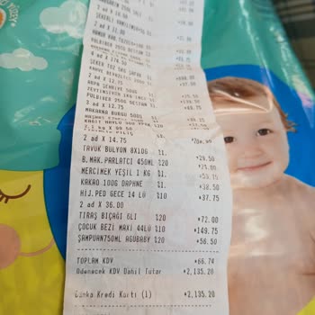 Kopuk Bantlı Bebek Bezi Sorunu